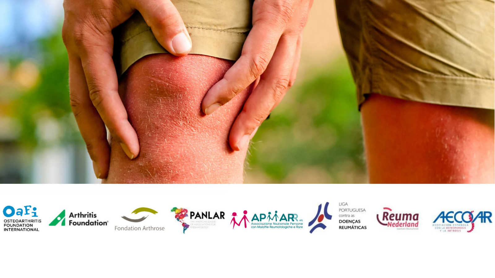 Il nuovo piano dell’International OA Patient Task Force per combattere l’osteoartrosi
