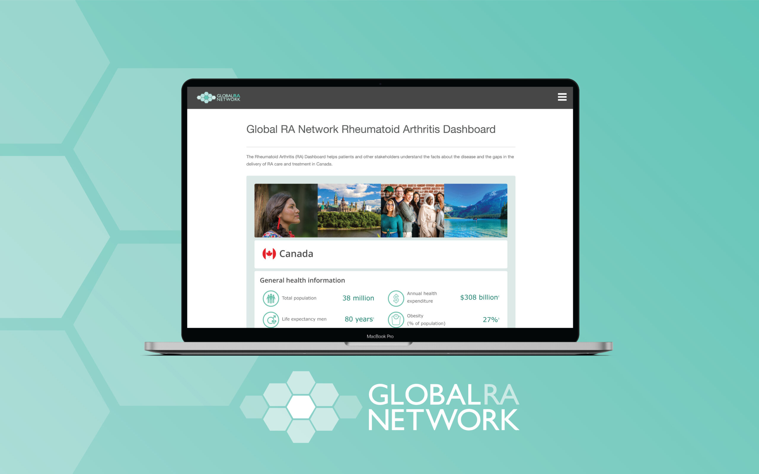 Il Global RA Network lancia il Dashboard sull’artrite reumatoide