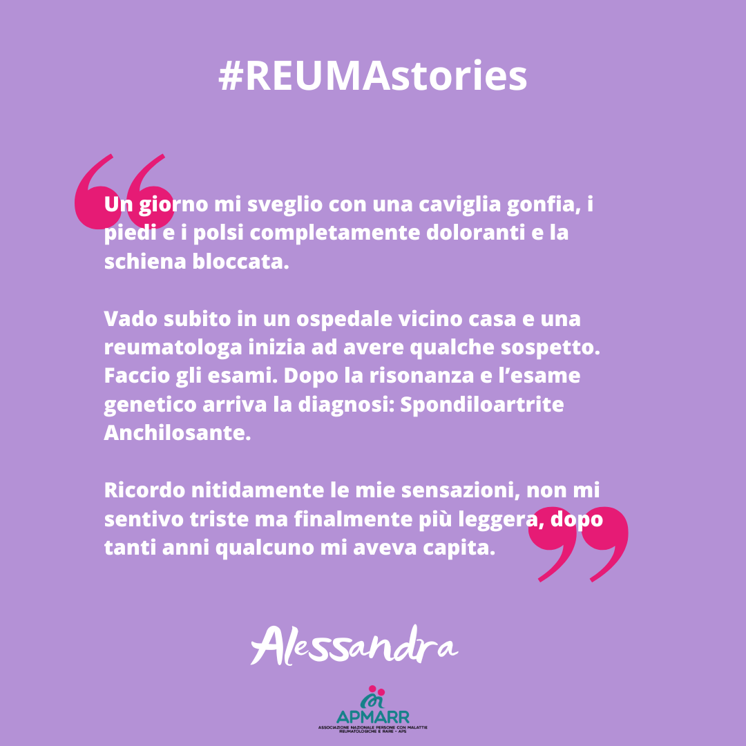 Reumastories, la testimonianza di Alessandra affetta da spondiloartrite anchilosante