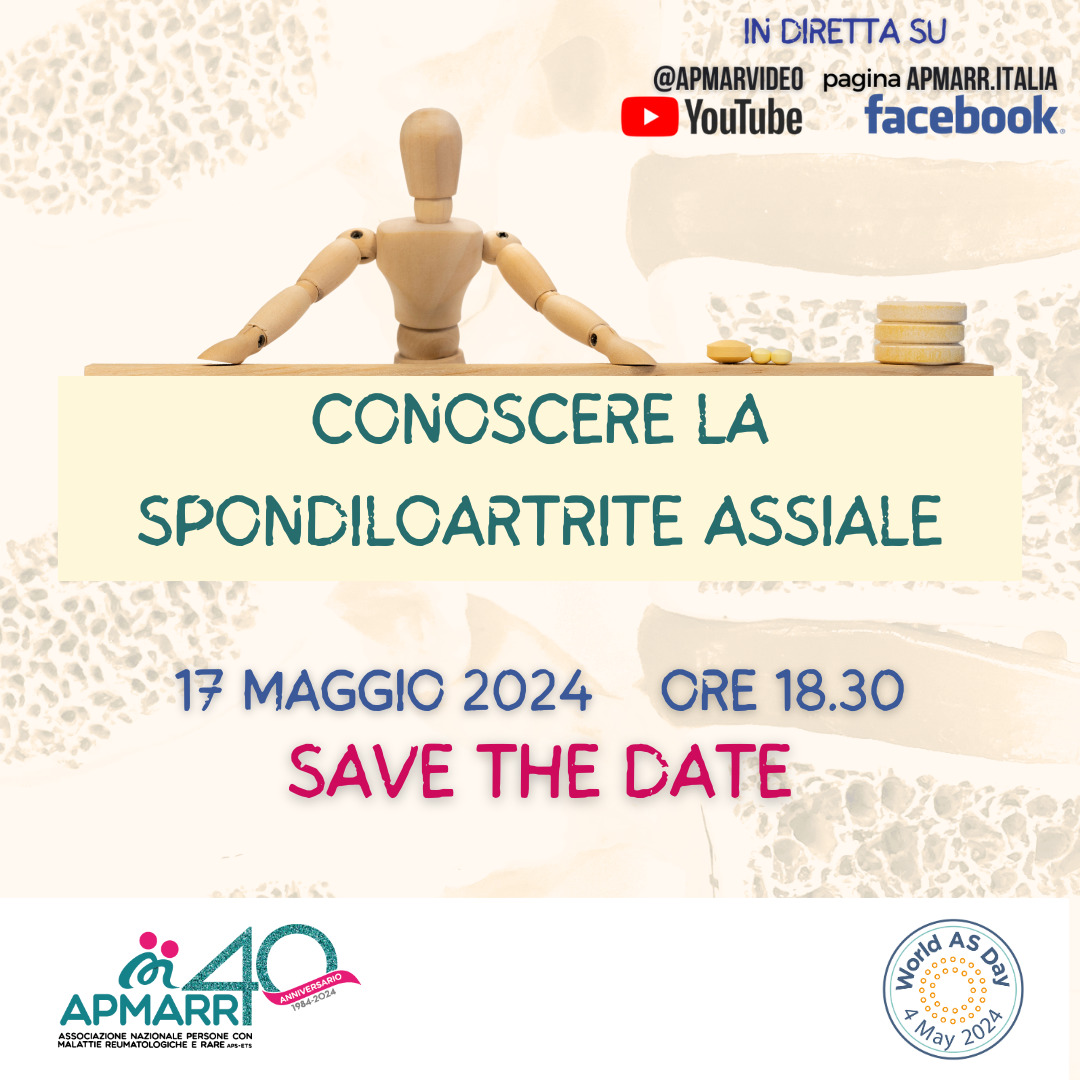 ALLARME SPONDILOARTRITE ASSIALE, A LIVELLO GLOBALE NE SOFFRE 1 PERSONA SU 150: ECCO I SEGNALI A CUI PRESTARE ATTENZIONE SECONDO GLI ESPERTI