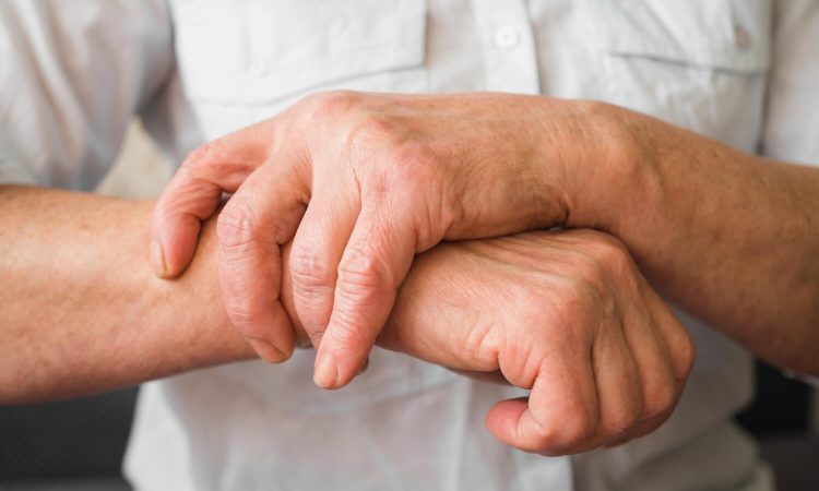 malattie reumatologiche apmarr